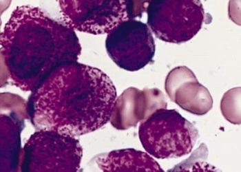 Rituximab linked with reduced chronic immune disease following stem cell transplantation