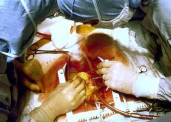 Remote ischemic preconditioning reduced myocardial injury in CABG patients