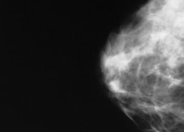 Certain cancer therapy innovations not associated with decreasing mortality