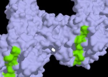 Lack of mucosal healing in celiac disease linked with increased risk of lymphoma