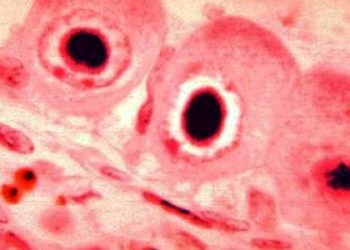 Effective CMV infection prophylaxis for hematopoietic-cell transplantation