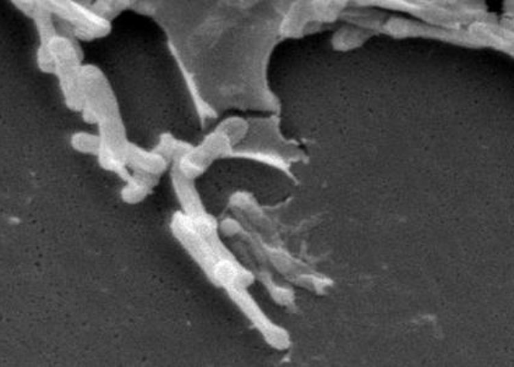 Half of C. difficile cases genetically distinct from previous cases