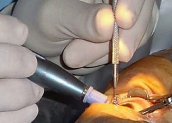 Statin use linked to increased risk of cataracts