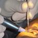 Statin use linked to increased risk of cataracts