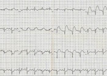 Computer more accurate than clinical gestalt in predicting ACS