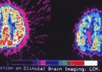 Parents’ ADHD treatment preferences predict treatment initiation