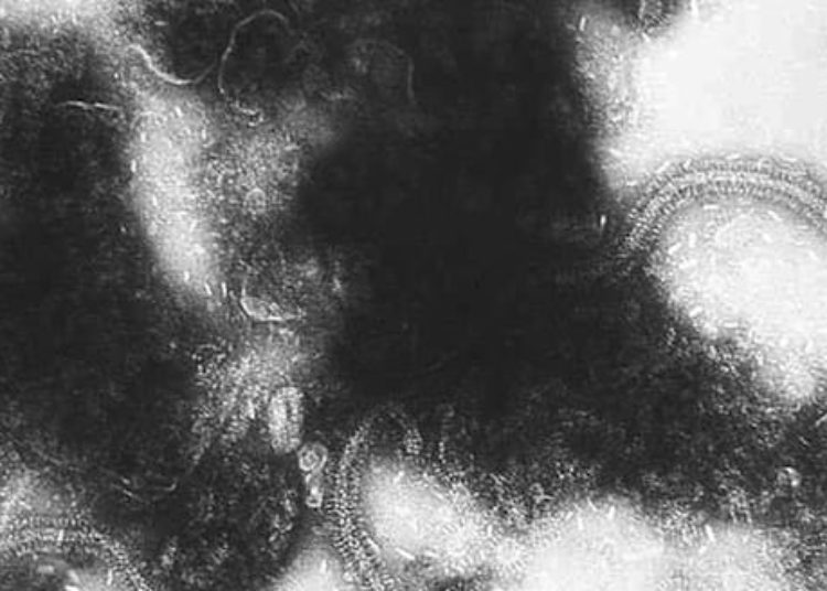 RSV positivity associated with reduced serious bacterial infection risk [Classics Series]