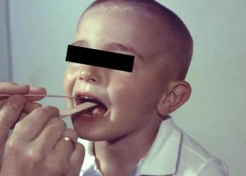 Clinical score effective in treating sore throat