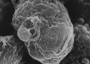 HIV-infected infant potentially cured with antiretroviral therapy