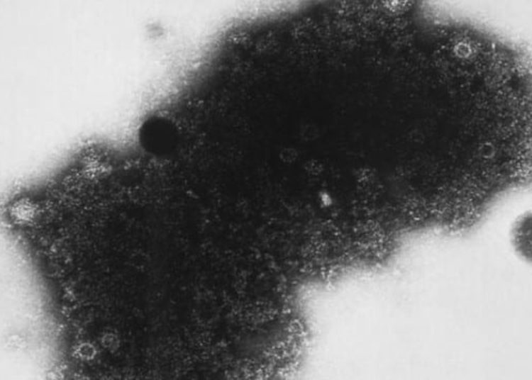 No differences in respiratory tract infection treatments