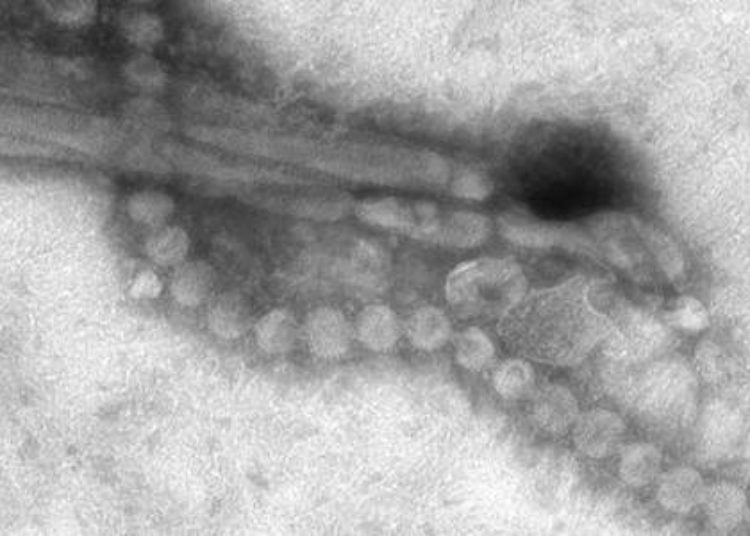 Influenza vaccine associated with lower risk of major cardiovascular events