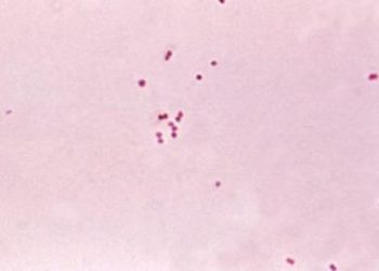 Increased risk of invasive meningococcal disease for patients with HIV