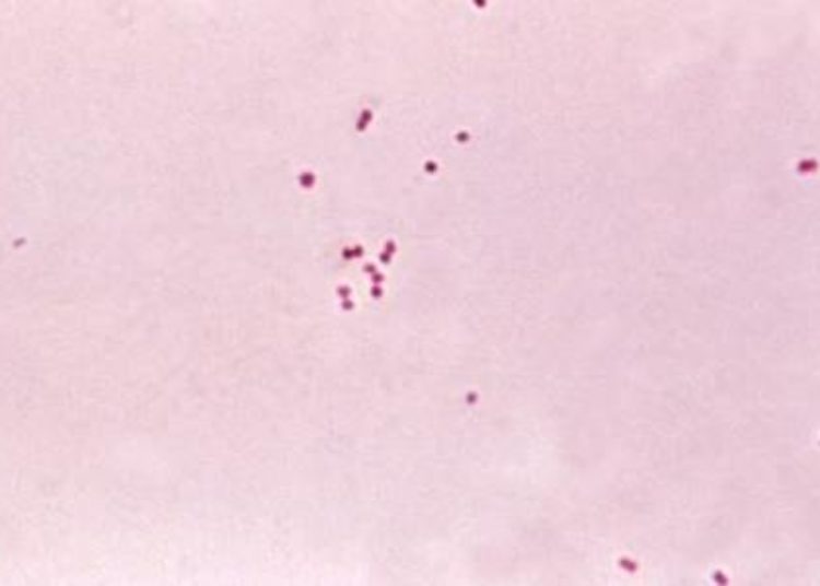 Increased risk of invasive meningococcal disease for patients with HIV