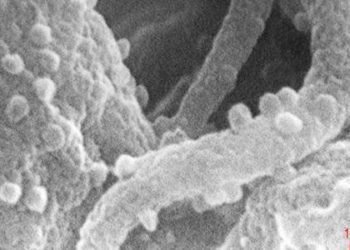 New pathogenic dimorphic fungal species suggested in HIV-positive patients