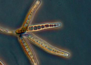 Exserohilum rostratum acquired by contaminated injections linked with broad disease