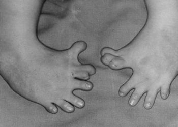 Shortage of evidence assessing teratogenic drugs