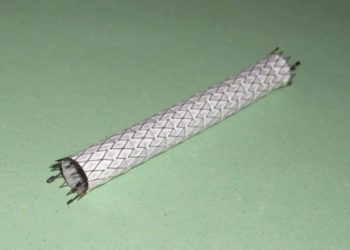 Stent type may not be related to adverse cardiac events after surgery