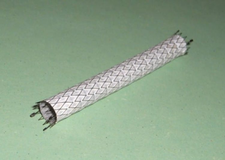 Stent type may not be related to adverse cardiac events after surgery