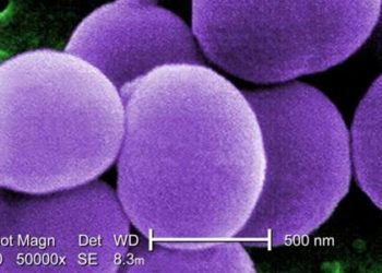 Increased infections noted with longer duration neonatal PICC placement