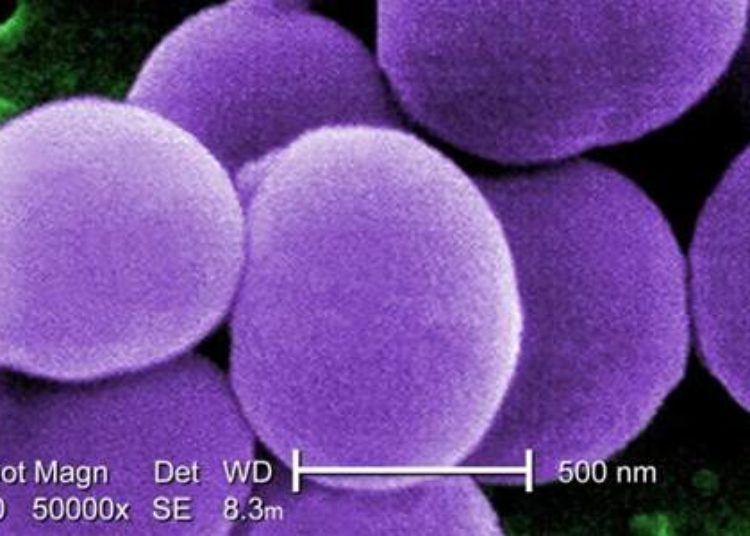 Increased infections noted with longer duration neonatal PICC placement