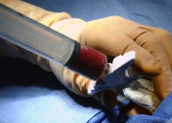 Two-pronged atorvastatin administration for prophylaxis of acute GVHD