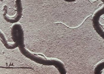 Repeat third trimester syphilis screening may not be cost effective