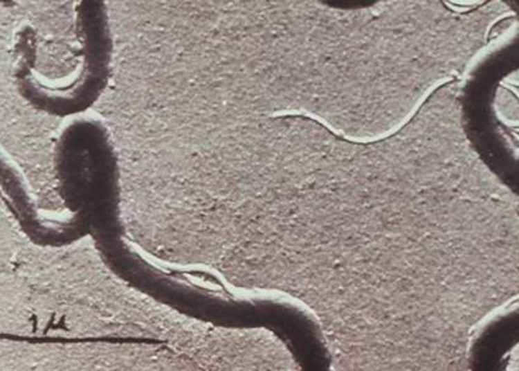 Repeat third trimester syphilis screening may not be cost effective