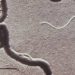 Repeat third trimester syphilis screening may not be cost effective