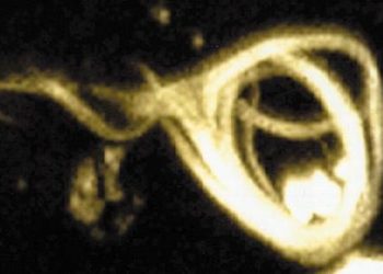 2 Minute Medicine Rewind December 31-January 6, 2013