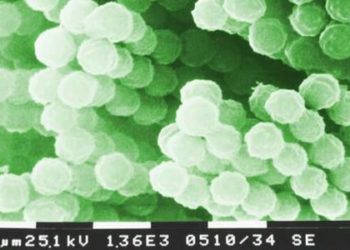 PTX3 gene deficiency may increase the risk of invasive aspergillosis in transplant patients