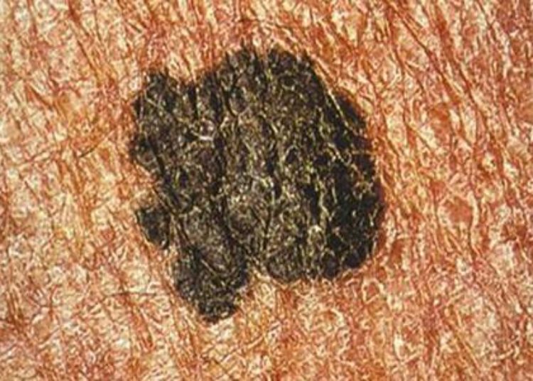 Teledermatology may be reliable in triaging inpatient dermatology consultations
