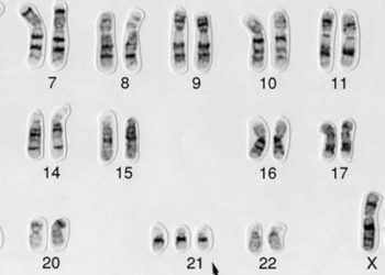 Maternal cell-free DNA sequencing superior to standard aneuploidy screening [CARE Study]