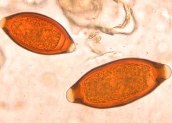 Oxantel pamoate results in higher cure rates of Trichuris trichiura in children