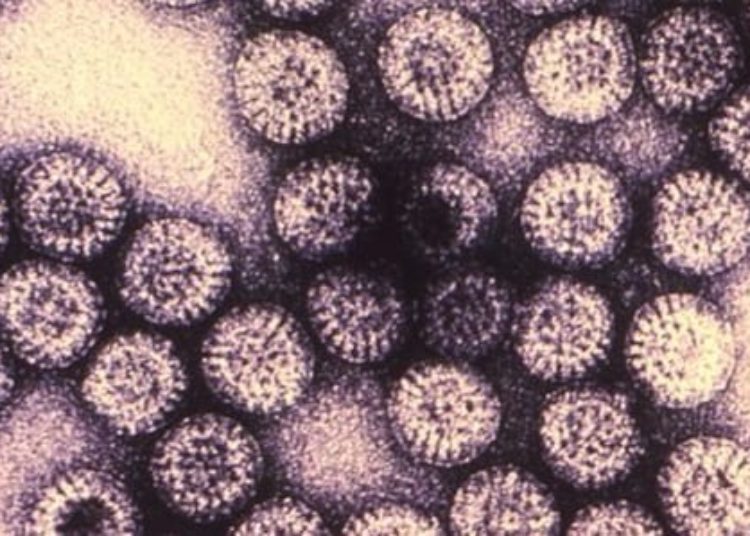Rotavirus vaccine associated with increased risk of intussusception