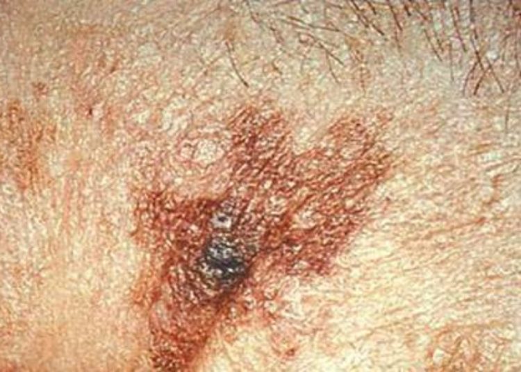 Video-based behavioral intervention benefits clinical skin examinations