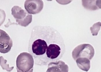 Entinostat plus azacitidine may not improve response for myelodysplastic syndrome