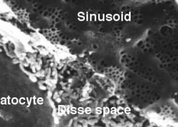 HLA-DRB1*07:01 confirmed as risk factor for lapatinib-induced liver damage