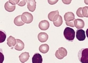 Combined lenalidomide and rituximab dose escalation found to be safe for CLL
