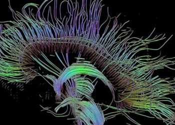 Diffusion tensor imaging valuable in the evaluation of peripheral neuropathy
