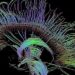 Diffusion tensor imaging valuable in the evaluation of peripheral neuropathy
