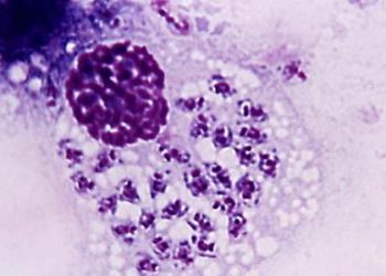 New drug for Chagas disease shows antitrypanosomal activity [CHAGASAZOL trial]