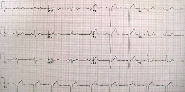 1280px-LBBB2009