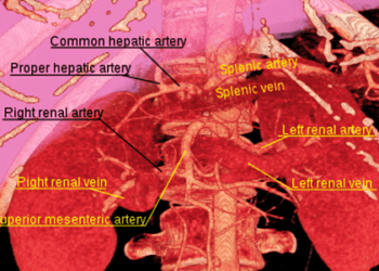 Antibodies against apoptotic cells may predict kidney transplant rejection