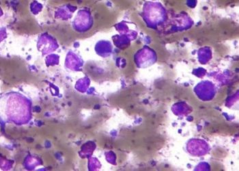 Mutation linked with decrease in cutaneous diffuse large B-cell lymphoma