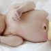 Impaired brain growth in preterm infants linked with delayed cognitive development