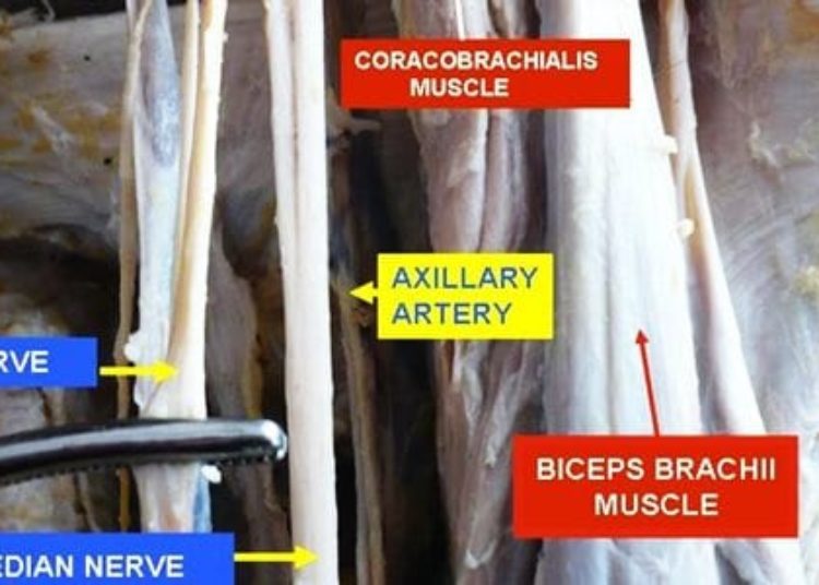 Risk of delayed-onset ulnar neuritis after arthroscopic release of elbow contracture