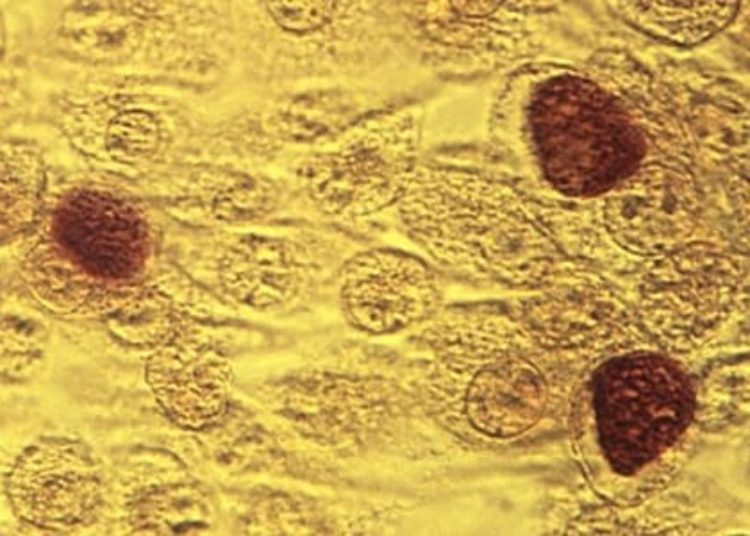 USPSTF recommends routinely screening asymptomatic women for chlamydia and gonorrhea