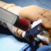 Gender mismatch linked with autoimmune disease in chronic graft-vs-host disease