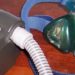 Admission may not be needed following sleep apnea surgery
