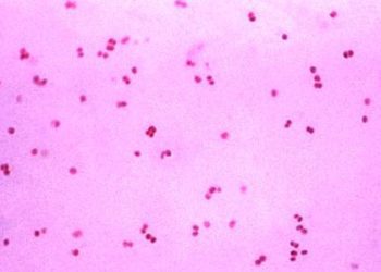 USPSTF recommends routinely screening asymptomatic women for chlamydia and gonorrhea